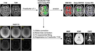 Association of brain tissue cerebrospinal fluid fraction with age in healthy cognitively normal adults